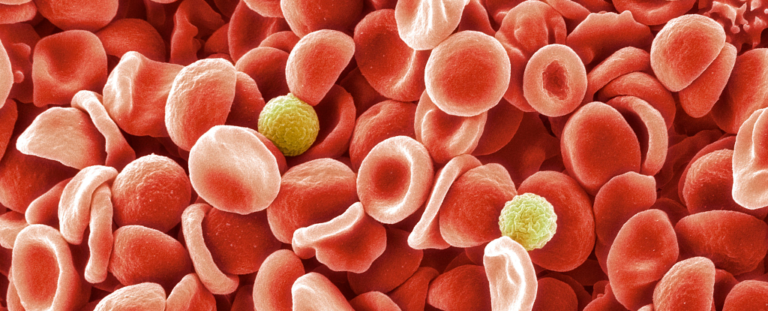 Shkencëtarët identifikojnë grupin e ri të gjakut pas misterit 50 vjeçar